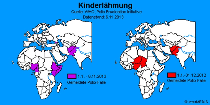 Kinderlähmung | Infektionserkrankungen